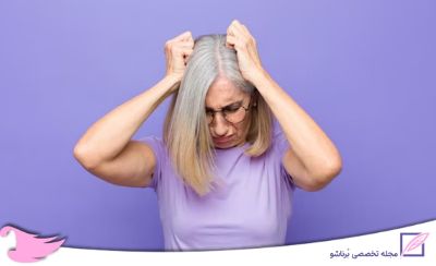 درمان ریزش مو در دوران یائسگی